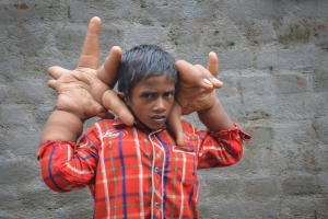 Eight-year-old-Kaleems-hands-03.jpg